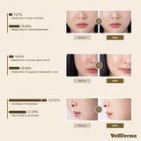 WellDerma Premium Facial Fitting Mask (25g X 4 Ea) มาร์คกระชับใบหน้าคุณภาพสูง