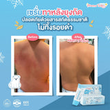 Mama Tales Soothing Serum มาม่าเทลส์ เซรั่มทาหลังยุงกัด ลดคัน รอยแดง ใช้ได้ตั้งแต่แรกเกิด (12g) - Organic Pavilion