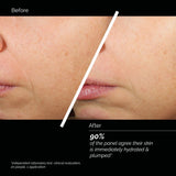 Skin Regimen LX HA4 Jelly Serum (30ml) เซรั่มเพื่อฟื้นฟู ความอิ่มเอิบ ช่วยให้ผิวเรียบและเนียนนุ่ม เหมาะกับผิวแพ้ง่าย