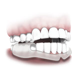 Plackers Grind No More Dental Night Protectors บดไม่มีอุปกรณ์ป้องกันฟันกลางคืนอีกต่อไป 10 pcs. - Organic Pavilion